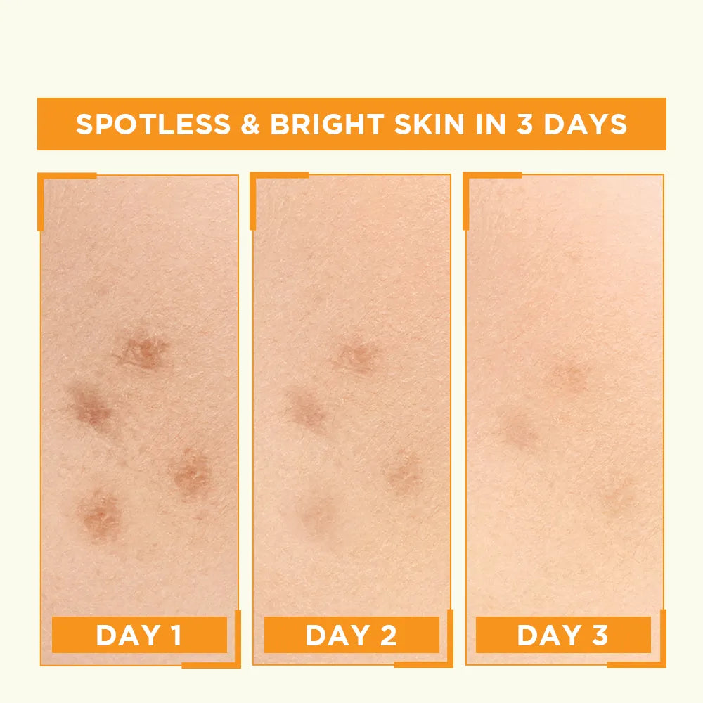 Garnier Skin Active Bright Complete Vitamin C Booster Serum 30 ML - Contains Niacinamide